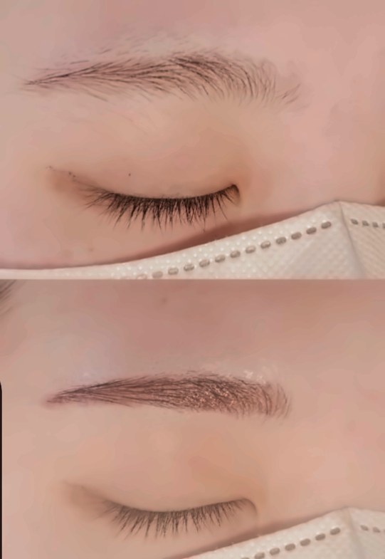 眉アートメイク症例3