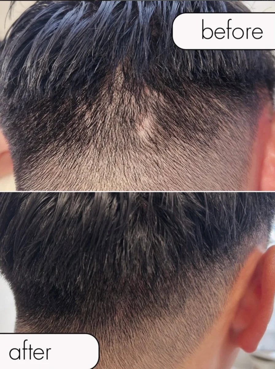 Before / After