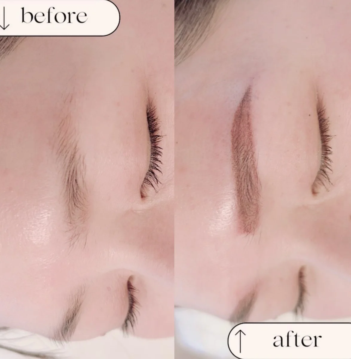 Before / After